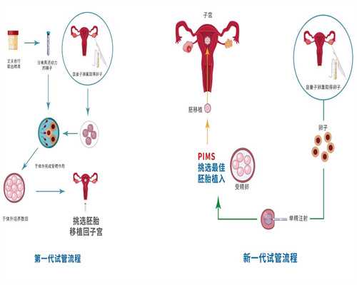 泰国三代试管费用解析：18万传闻与真实开销对比