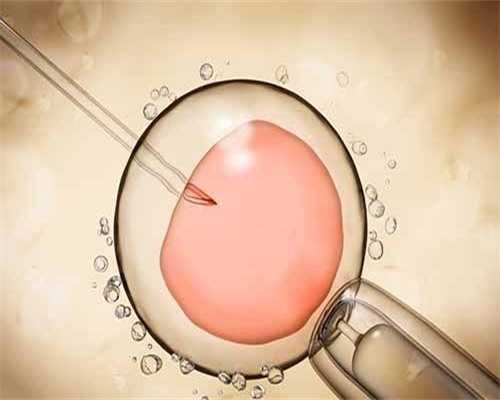 2026年上海一妇婴高龄三代试管婴儿成功率解析及供卵代怀费用指南
